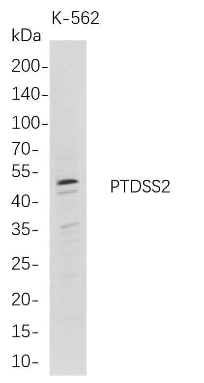 Anti-Human PTDSS2 Antibody [B711] - ABMIUM