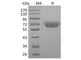 Recombinant Human Kininogen 1/KNG1 Protein (His Tag) - ABMIUM