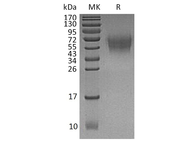 Recombinant Human CD226/DNAM-1 Protein (His Tag) - ABMIUM