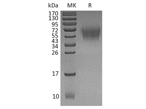 Recombinant Human CD226/DNAM-1 Protein (His Tag) - ABMIUM