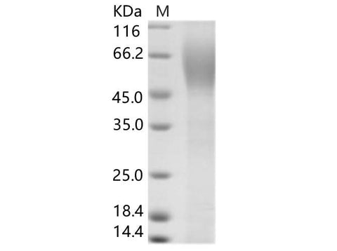Recombinant HCV (serotype 1b, isolate HC-J4) Envelope / E2 Protein (His Tag) - ABMIUM