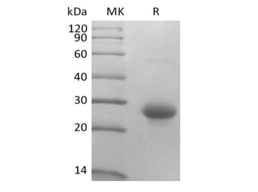Recombinant Mouse CD27 Ligand/TNFSF7/CD70 (N-10His) - ABMIUM