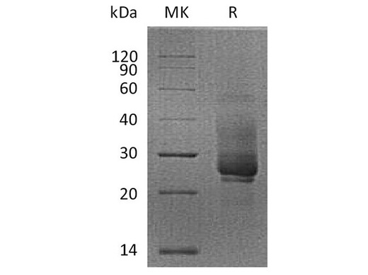Recombinant Cynomolgus TIM-3/HAVCR2 Protein (His Tag) - ABMIUM