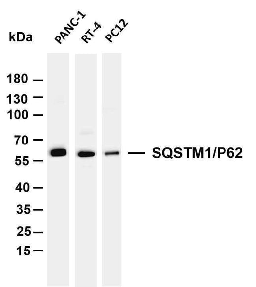 Anti-Human/Mouse/Rat SQSTM1/p62 Antibody [B1150] - ABMIUM