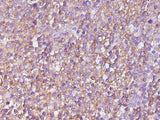 Anti-Human/Mouse CASP4 Antibody - ABMIUM