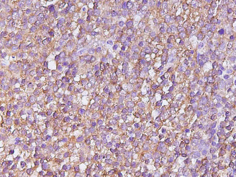 Anti-Human/Mouse CASP4 Antibody - ABMIUM