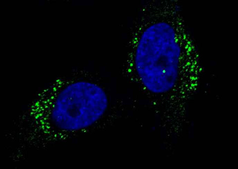 Anti-Human CTSA Antibody [B262] - ABMIUM