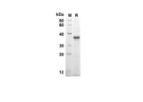 SDS-PAGE analysis of Human CASP8 proteins, 2 μg/lane of Recombinant Human CASP8 proteins was resolved with SDS-PAGE under reducing conditions, showing bands at 30.3 kDa.