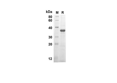 SDS-PAGE analysis of Human CASP8 proteins, 2 μg/lane of Recombinant Human CASP8 proteins was resolved with SDS-PAGE under reducing conditions, showing bands at 30.3 kDa.