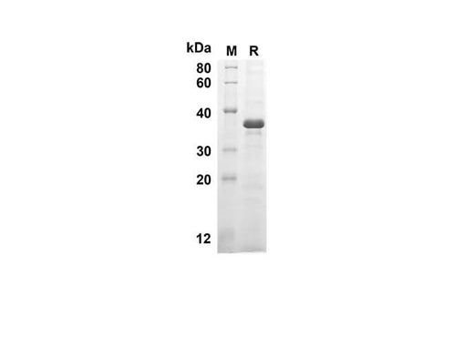 SDS-PAGE analysis of Human CASP8 proteins, 2 μg/lane of Recombinant Human CASP8 proteins was resolved with SDS-PAGE under reducing conditions, showing bands at 30.3 kDa.