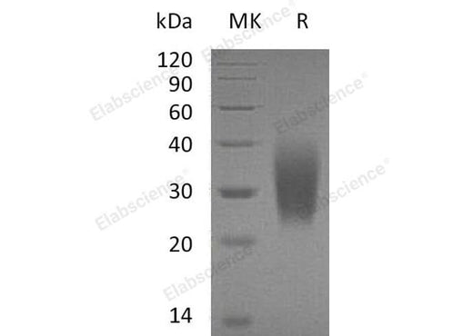 Recombinant Human PTH1R Protein (Gly49, His Tag) - ABMIUM