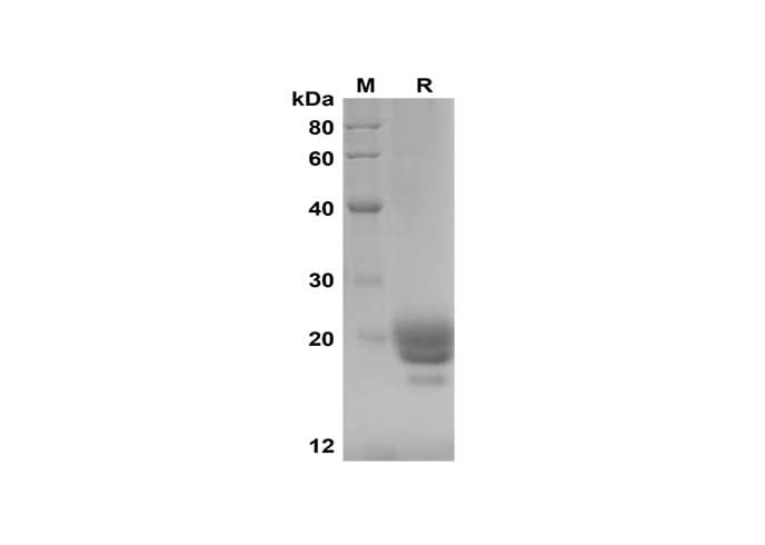SDS-PAGE analysis of Mouse IFNα2 proteins, 2 μg/lane of Recombinant Mouse IFNα2 proteins was resolved with SDS-PAGE under reducing conditions, showing bands at 18-20 kDa.