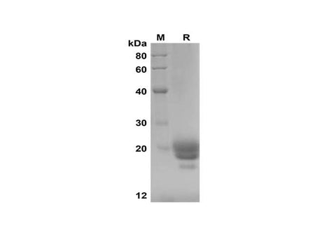 SDS-PAGE analysis of Mouse IFNα2 proteins, 2 μg/lane of Recombinant Mouse IFNα2 proteins was resolved with SDS-PAGE under reducing conditions, showing bands at 18-20 kDa.