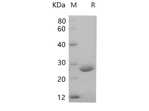 SDS-PAGE analysis of Mouse Prolactin/Prl proteins, 2 μg/lane of Recombinant Mouse Prolactin/Prl proteins was resolved with SDS-PAGE under reducing conditions, showing bands at 24-28 kDa.