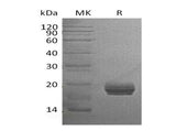 Recombinant Human GM2A Protein (Human Cells, His Tag) - ABMIUM