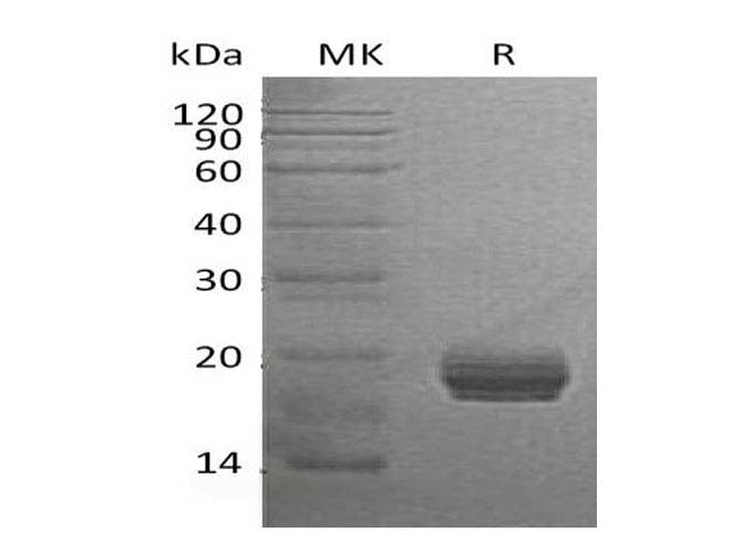 Recombinant Human GM2A Protein (Human Cells, His Tag) - ABMIUM