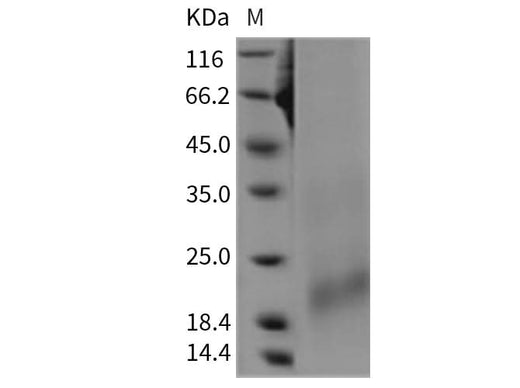 Recombinant Rat BAFFR/TNFRSF13C Protein (His Tag) - ABMIUM