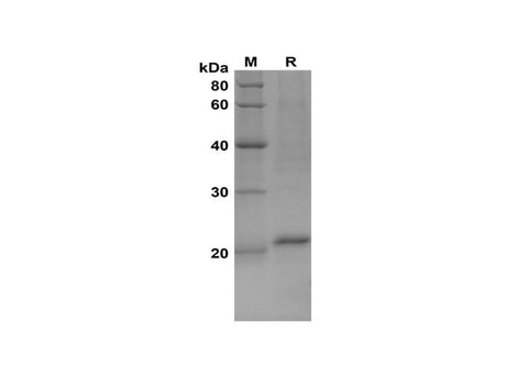 SDS-PAGE analysis of Human NOTCH3 proteins, 2 μg/lane of Recombinant Human NOTCH3 proteins was resolved with SDS-PAGE under reducing conditions, showing bands at 21 kDa.