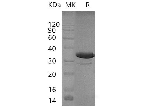 Recombinant Human QPRT/QPRTase Protein (His Tag) - ABMIUM