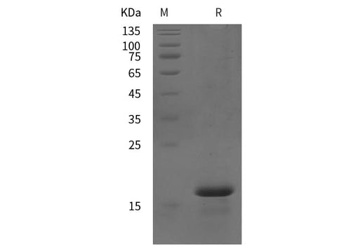 SDS-PAGE analysis of Human NT proteins, 2 μg/lane of Recombinant Human NT proteins was resolved with SDS-PAGE under reducing conditions, showing bands at 17 kDa.