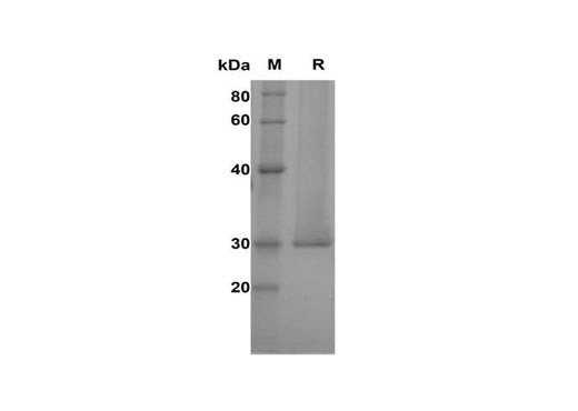 SDS-PAGE analysis of Human RAB11A proteins, 2 μg/lane of Recombinant Human RAB11A proteins was resolved with SDS-PAGE under reducing conditions, showing bands at 30 kDa.