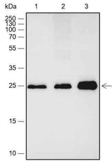 Anti-Human/Rat/Mouse Calbindin Antibody [A486]