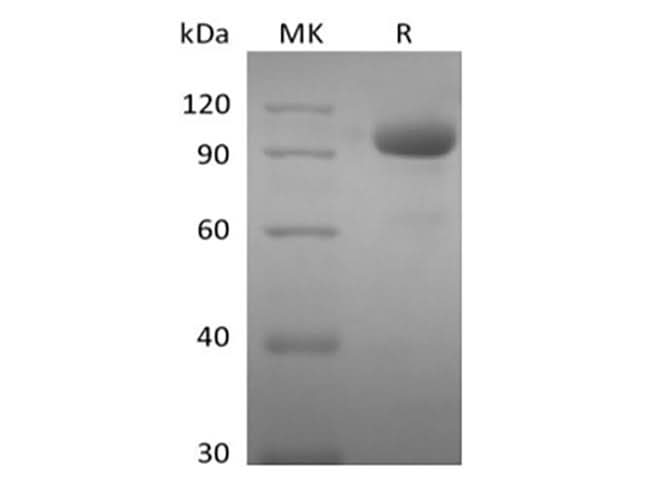 Recombinant Human EPHA8 (C-Fc) - ABMIUM