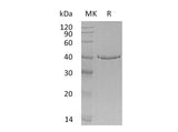 Recombinant Human GMPR Protein (Human Cells, His Tag) - ABMIUM