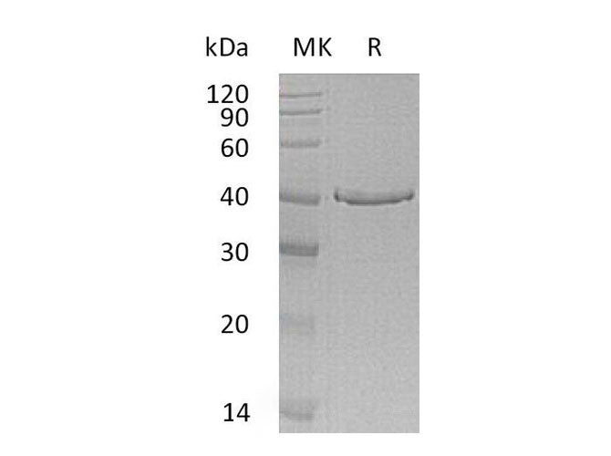 Recombinant Human GMPR Protein (Human Cells, His Tag) - ABMIUM