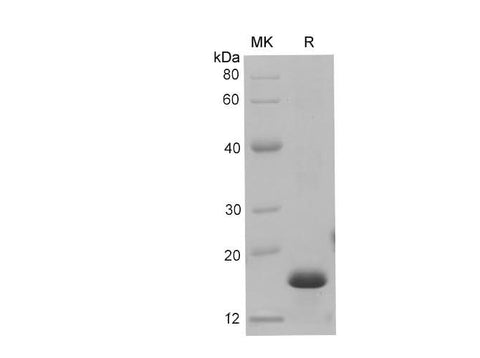 SDS-PAGE analysis of Mouse S100a9 proteins, 2 μg/lane of Recombinant Mouse S100a9 proteins was resolved with SDS-PAGE under reducing conditions, showing bands at 15-18 kDa.