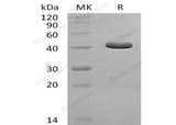 Recombinant Human GCDH Protein (His Tag) - ABMIUM