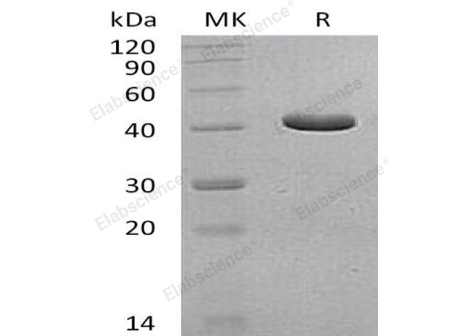 Recombinant Human GCDH Protein (His Tag) - ABMIUM