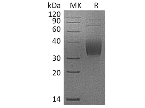 Recombinant Cynomolgus PD-L2/B7-DC/CD273 Protein (His Tag) - ABMIUM