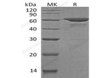 Recombinant Human SOAT2/ACAT2 Protein (His&Trx Tag) - ABMIUM