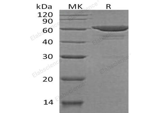 Recombinant Human SOAT2/ACAT2 Protein (His&Trx Tag) - ABMIUM