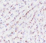 Anti-Human ABCB11/BSEP Antibody [A145]