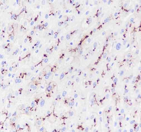 Anti-Human ABCB11/BSEP Antibody [A145] - ABMIUM