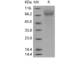 SDS-PAGE analysis of Human GP4/CD36 proteins, 2 μg/lane of Recombinant Human GP4/CD36 proteins was resolved with SDS-PAGE under reducing conditions, showing bands at 80 kDa.