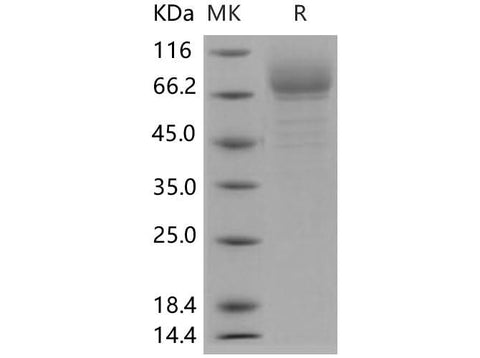 SDS-PAGE analysis of Human GP4/CD36 proteins, 2 μg/lane of Recombinant Human GP4/CD36 proteins was resolved with SDS-PAGE under reducing conditions, showing bands at 80 kDa.
