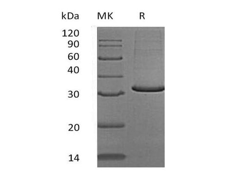 Recombinant Human SCGN/Secretagogin Protein (Human Cells, His Tag) - ABMIUM