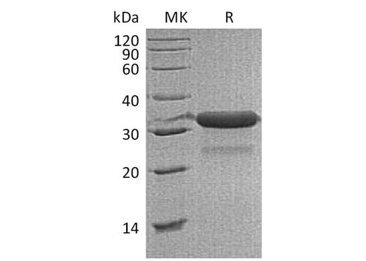 Recombinant Mouse IGFBP-7/IGFBP7 Protein (His Tag) - ABMIUM