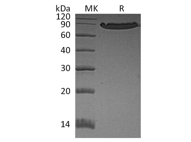 Recombinant Human E-Cadherin/CDH1 Protein (His Tag) - ABMIUM
