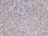 Anti-Human SDHB Antibody - ABMIUM