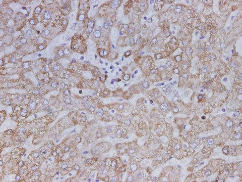 Anti-Human SDHB Antibody - ABMIUM