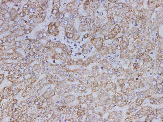 Anti-Human SDHB Antibody - ABMIUM