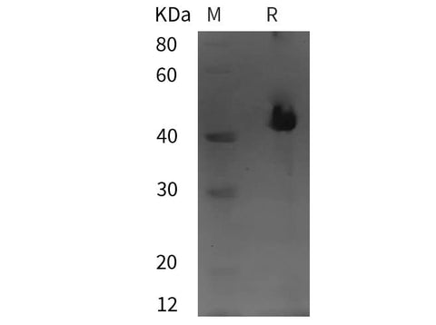 SDS-PAGE analysis of Human MAPK9 proteins, 2 μg/lane of Recombinant Human MAPK9 proteins was resolved with SDS-PAGE under reducing conditions, showing bands at 41 kDa.