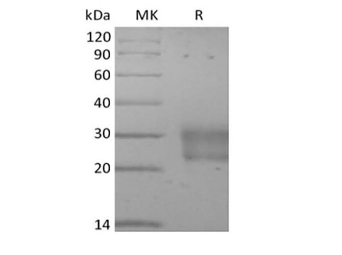 Recombinant Human Frizzled-8 (C-6His) - ABMIUM