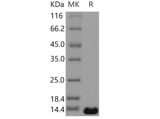 Recombinant Human PTH2/PTRH2 Protein (His Tag) - ABMIUM