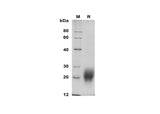SDS-PAGE analysis of Human FSH-b proteins, 2 μg/lane of Recombinant Human FSH-b proteins was resolved with SDS-PAGE under reducing conditions, showing bands at 20-28 kDa.