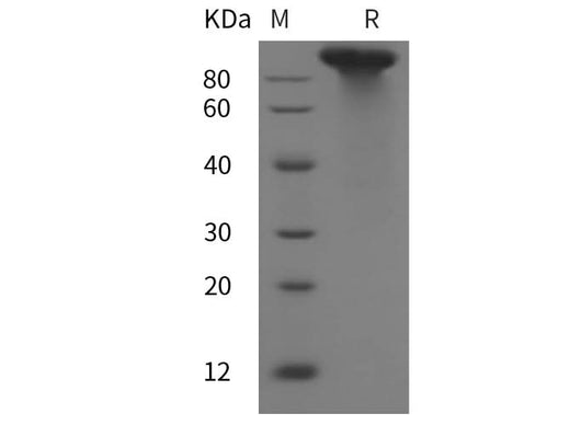 SDS-PAGE analysis of Mouse LDLR proteins, 2 μg/lane of Recombinant Mouse LDLR proteins was resolved with SDS-PAGE under reducing conditions, showing bands at 90 kDa.